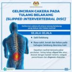 Gelinciran cakera pada tulang belakang ( slipped disc) boleh berlaku kepada golongan muda